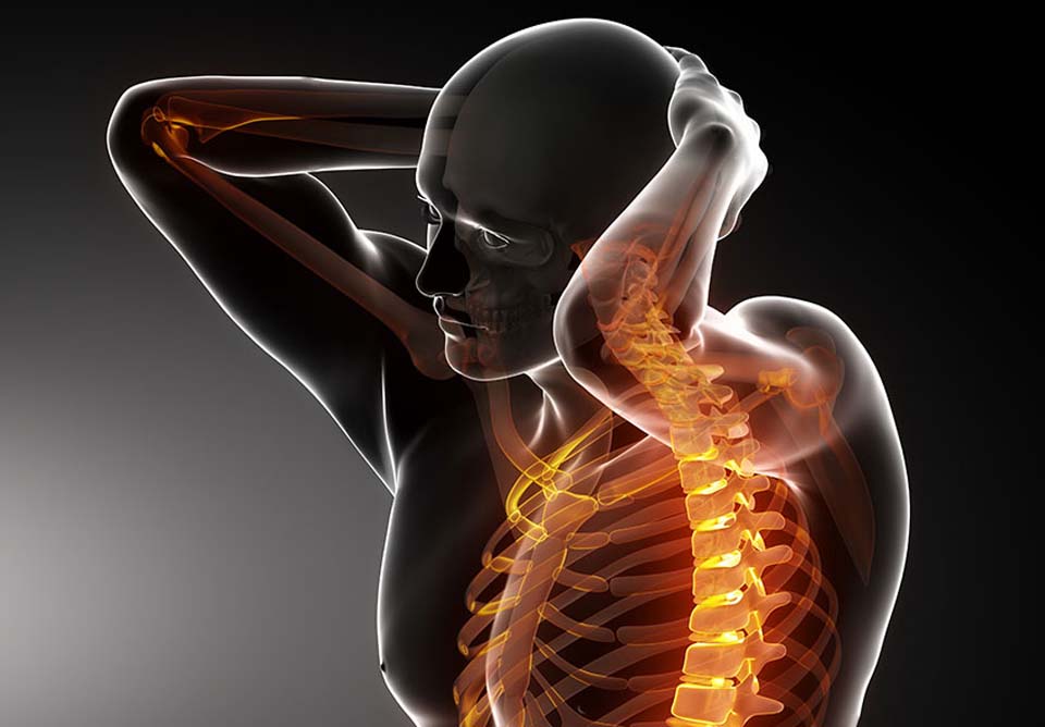عضلات زیادی در بالا تنه به دردهای عضلانی دچار می‌شوند چون در چرخه تکامل وظایف خاصی برای اون‌ها تعریف شده و معمولاً در زندگی مدرن به شکل متفاوتی استفاده می‌شوند.